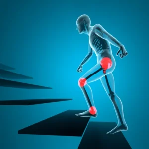 جلوگیری از زانودرد با پله رو نیکصا